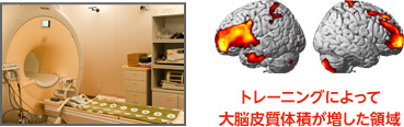 トレーニングによって大脳皮質体積が増した領域