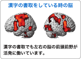 漢字の書取をしているときの脳：漢字の書取でも左右の脳の前頭前野が活発に働いています。